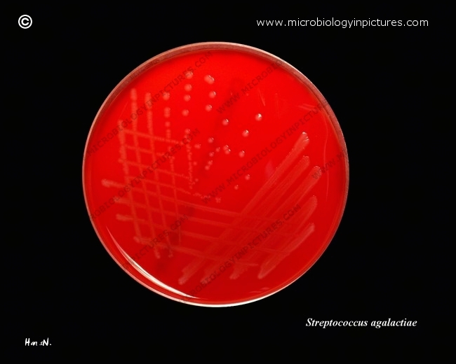 Streptococcus agalactiae; weak beta-hemolysis streptococcus agalactiae on sheep blood agar plate